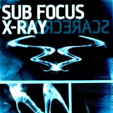 Sub Focus: X Ray