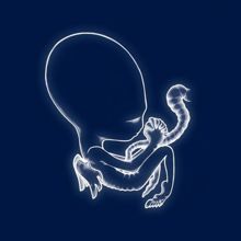 Sigur Rós: Ágætis byrjun